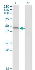 Carboxypeptidase A1 Monoclonal Antibody (3F11)