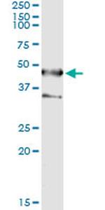 Septin 1 Antibody in Immunoprecipitation (IP)