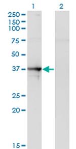 Septin 1 Antibody in Western Blot (WB)