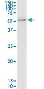 eIF2d Antibody in Western Blot (WB)