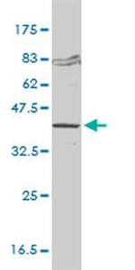 FVT1 Monoclonal Antibody (2B2-3C11)