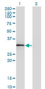 HOXA1/HOXB1/HOXD1 Monoclonal Antibody (2F12)
