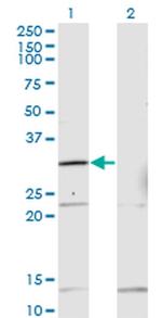 HOXA1/HOXB1/HOXD1 Monoclonal Antibody (2E5)