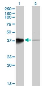 HOXB5 Antibody in Western Blot (WB)