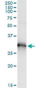 HOXB9 Antibody in Immunoprecipitation (IP)