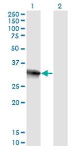 HOXB9 Antibody in Western Blot (WB)
