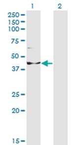 INPP1 Monoclonal Antibody (1A6)