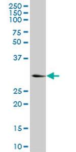 KHK Antibody in Western Blot (WB)