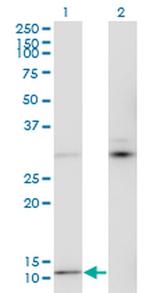 MTCP1 Monoclonal Antibody (1G12)