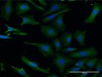 LIS1 Monoclonal Antibody (5A5)