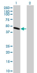 LIS1 Antibody in Western Blot (WB)