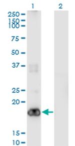 PIGH Monoclonal Antibody (2F8)