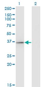 RFXAP Monoclonal Antibody (1B5)