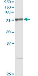 RNPEP Monoclonal Antibody (4E1)