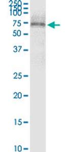 SCTR Antibody in Western Blot (WB)