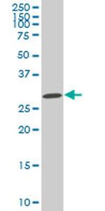 SIX3 Monoclonal Antibody (4H6)