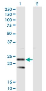 SSR2 Antibody in Western Blot (WB)
