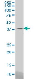 STAC Monoclonal Antibody (2C5)
