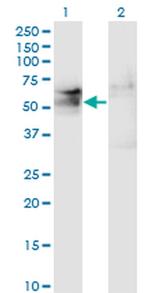 TSPYL1 Antibody in Western Blot (WB)