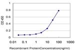 ZNF31 Antibody in ELISA (ELISA)