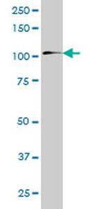 ZNF31 Antibody in Western Blot (WB)