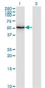 ZNF38 Monoclonal Antibody (4B11)