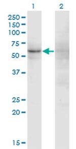 ZNF180 Monoclonal Antibody (4F3)