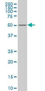 ZNF213 Antibody in Western Blot (WB)