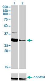 ZNF215 Monoclonal Antibody (2C11)