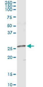 NME5 Monoclonal Antibody (4F5)