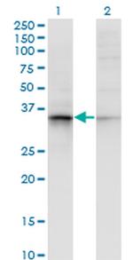 AKR7A2 Monoclonal Antibody (2H3)