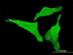 CDKL2 Antibody in Immunocytochemistry (ICC/IF)