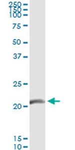GCAP3 Monoclonal Antibody (3F10)