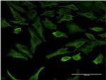 SGK2 Monoclonal Antibody (2F6)