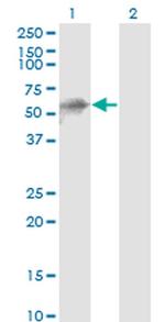 KLHL41 Antibody in Western Blot (WB)