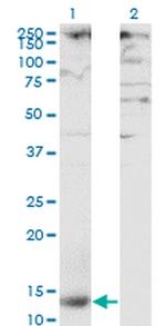 CD299 (DC-SIGN/L) Monoclonal Antibody (2G1)