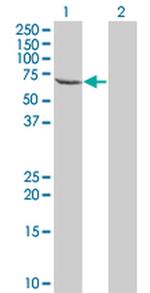 TESK2 Antibody in Western Blot (WB)
