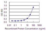 LRRN2 Antibody in ELISA (ELISA)
