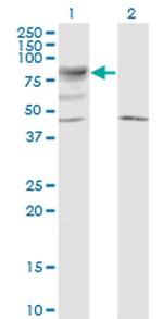 LRRN2 Monoclonal Antibody (6A9)
