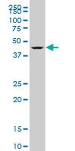 DEAF1 Antibody in Western Blot (WB)