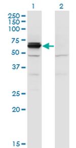CRMP3 Monoclonal Antibody (1F5)