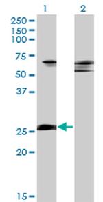 ZNF266 Antibody in Western Blot (WB)