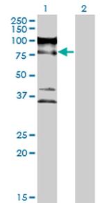 ZNF274 Antibody in Western Blot (WB)