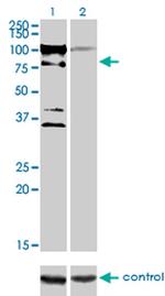 ZNF274 Antibody in Western Blot (WB)