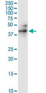 RUNDC3A Monoclonal Antibody (1A8)