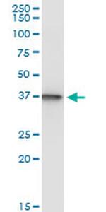 SUGT1 Antibody in Immunoprecipitation (IP)