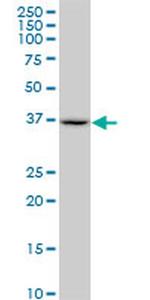 SUGT1 Antibody in Western Blot (WB)
