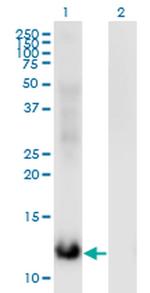 MSRB2 Monoclonal Antibody (3F12)