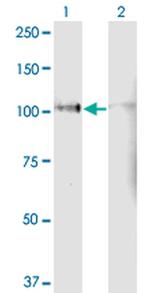 LPIN1 Monoclonal Antibody (3D9)
