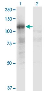 PLCL2 Monoclonal Antibody (1C7)